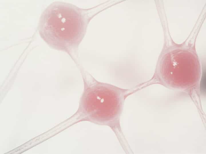 Odbudować umysł po udarze: kluczowa rola neuropsychologa w rehabilitacji